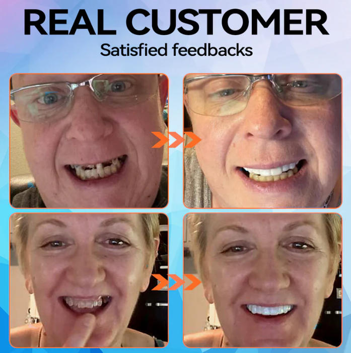 Adjustable Snap-On Dentures